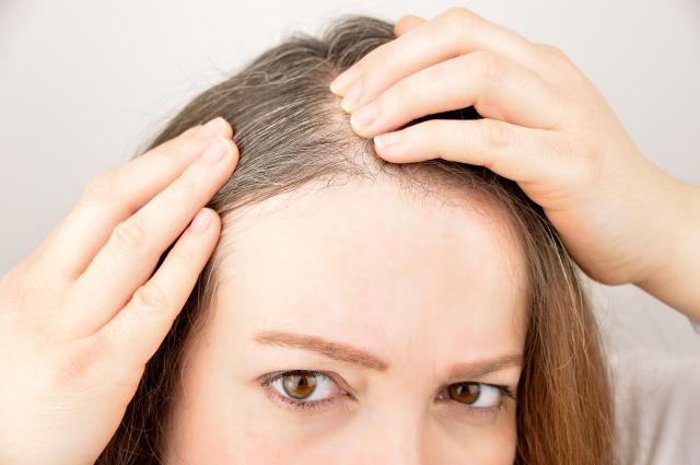 Nauènici upozoravaju: Evo šta još može biti uzrok sede kose